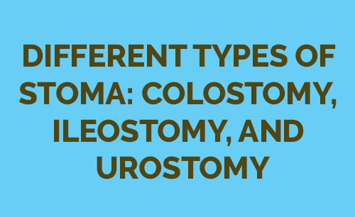 Different Types of Stoma: Colostomy, Ileostomy, and Urostomy